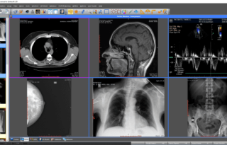 Sante DICOM Editor 10.4.1