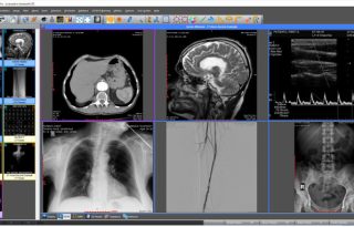 Sante DICOM Viewer Pro 14.4.1